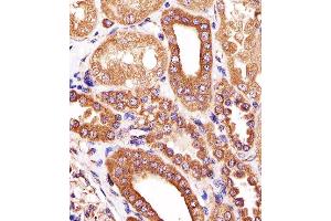 Paraformaldehyde-fixed, paraffin embedded human kidney tissue, Antigen retrieval by boiling in sodium citrate buffer (pH6. (ATG3 抗体)