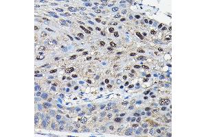 Immunohistochemistry (IHC) image for anti-Suppressor of Fused Homolog (SUFUH) (AA 325-484) antibody (ABIN6148692)