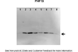 Lanes:   1. (PHF19 抗体  (C-Term))