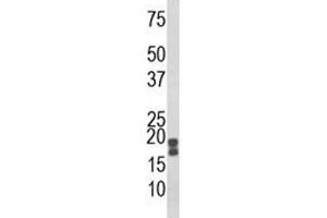 Western blot analysis of ACP1 antibody and human HeLa lysate. (ACP1 抗体  (AA 33-61))