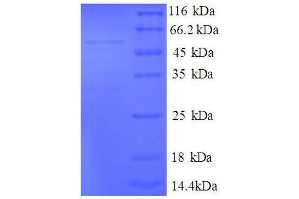 MRPL9 Protein (AA 60-267, full length) (GST tag)