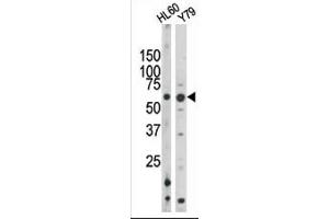 The anti-Phospho-Rad9- Pab (ABIN389633 and ABIN2839629) is used in Western blot to detect Phospho-Rad9- in HL60 (left) and Y79 (right) tissue lysates. (RAD9A 抗体  (pSer328))