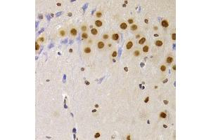 Immunohistochemistry of paraffin-embedded rat brain using HNRNPA1 Antibody (ABIN5975570) at dilution of 1/100 (40x lens). (HNRNPA1 抗体)