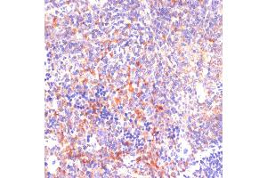 Immunohistochemistry of paraffin-embedded mouse spleen using ROCK1 antibody (ABIN6129454, ABIN6147066, ABIN6147067 and ABIN7101352) at dilution of 1:100 (40x lens). (ROCK1 抗体  (AA 400-660))