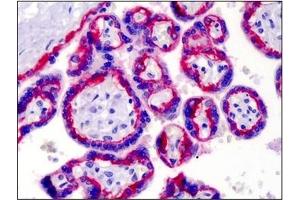 Immunohistochemistry (IHC) image for anti-Integrin beta 4 (ITGB4) antibody (ABIN614431) (Integrin beta 4 抗体)
