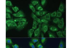 Immunofluorescence analysis of U-2 OS cells using EIF3D Polyclonal Antibody at dilution of 1:100. (EIF3D 抗体)
