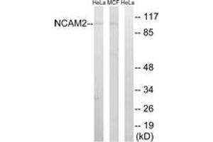 Western blot analysis of extracts from MCF-7/HeLa cells, using NCAM2 Antibody. (NCAM2 抗体  (AA 264-313))