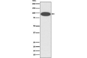 Western blot analysis of CD18 expression in K562 cell lysate.
