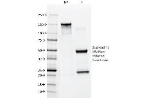 SDS-PAGE Analysis Purified Cytokeratin 10 Mouse Monoclonal Antibody (AE20). (Keratin 10 抗体)