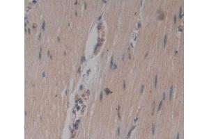 IHC-P analysis of Kidney tissue, with DAB staining. (Junctophilin 1 抗体  (AA 1-201))
