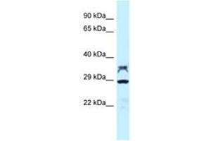 Image no. 1 for anti-Protein Phosphatase 2, Catalytic Subunit, alpha Isozyme (PPP2CA) (AA 188-237) antibody (ABIN6747823) (PPP2CA 抗体  (AA 188-237))