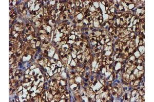 Image no. 4 for anti-Proteasome (Prosome, Macropain) Subunit, beta Type, 9 (Large Multifunctional Peptidase 2) (PSMB9) (AA 21-219) antibody (ABIN1491194)