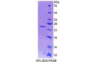 SDS-PAGE analysis of Mouse NIN Protein. (Ninein 蛋白)