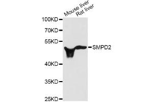 Western blot analysis of extracts of various cell lines, using SMPD2 antibody (ABIN1874877) at 1:3000 dilution. (SMPD2 抗体)