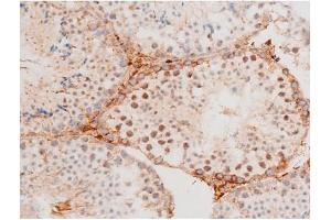 Immunohistochemistry (IHC) image for anti-Forkhead Box O4 (FOXO4) (pThr451) antibody (ABIN6256565)