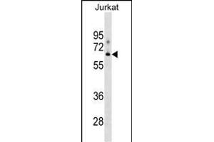 XYLB Antibody (N-term) (ABIN1539119 and ABIN2849290) western blot analysis in Jurkat cell line lysates (35 μg/lane).