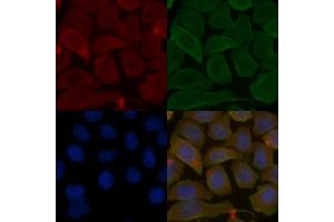 ABIN6263693 and ABIN6278598 staining Hela cells(30 min of UV treatment) by IF/ICC. (NOX1 抗体  (C-Term))