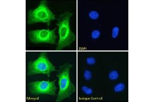 Immunofluorescence staining of fixed HeLa cells with anti-NFKB2 antibody SAIC-26C-15. (Recombinant NFKB2 抗体)