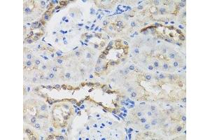 Immunohistochemistry of paraffin-embedded Rat kidney using B9D1 Polyclonal Antibody at dilution of 1:100 (40x lens). (B9D1 抗体)