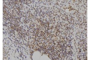 ABIN6273574 at 1/100 staining Human spleen tissue by IHC-P. (E2F7 抗体)