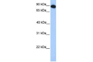 WB Suggested Anti-FOXO3 Antibody Titration:  0. (FOXO3 抗体  (N-Term))