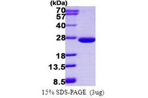 SDS-PAGE (SDS) image for ADP-Ribosylation Factor-Like 3 (ARL3) (AA 1-182) protein (His tag) (ABIN667566) (ARL3 Protein (AA 1-182) (His tag))