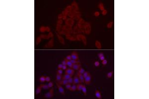 Immunofluorescence analysis of HeLa cells using PDE10A Rabbit pAb (ABIN7269297) at dilution of 1:25 (40x lens). (PDE10A 抗体  (AA 23-200))