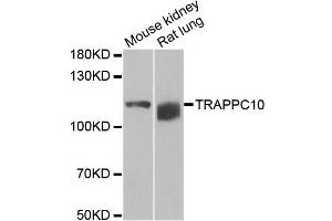 Western blot analysis of extracts of various cell lines, using TRAPPC10 antibody. (TRAPPC10 抗体)