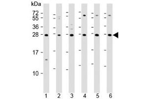 Western blot testing of 1) mouse EL4, human 2) fetal thymus, 3) spleen, 4) HUT78, 5) Jurkat and 6) Molt-4 lysate with TIGIT antibody. (TIGIT 抗体  (AA 12-142))