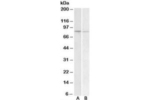 Western blot testing of human peripheral blood lymphocyte [A] and human spleen [B] lysate with BACH1 antibody at 1ug/ml. (BACH1 抗体)