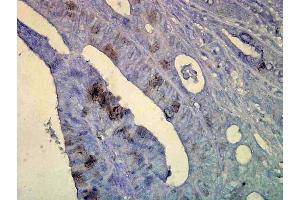 Immunohistochemistry analysis using Mouse Anti-Hsp70 Monoclonal Antibody, Clone C92 . (HSP70 抗体  (Biotin))