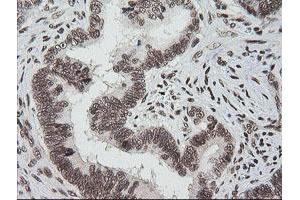 Image no. 7 for anti-Zinc Finger and SCAN Domain Containing 18 (ZSCAN18) antibody (ABIN1501857)
