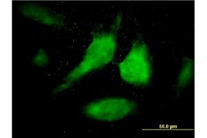 Immunofluorescence of monoclonal antibody to STAT1 on HeLa cell. (STAT1 抗体  (AA 613-712))