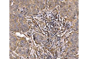 IHC analysis of PI 3 Kinase p85 alpha/PIK3R1 using anti-PI 3 Kinase p85 alpha/PIK3R1 antibody (ABIN7599781).