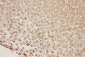 Anti-HNF1 beta antibody, IHC(P) IHC(P): Mouse Liver Tissue (HNF1B 抗体  (C-Term))