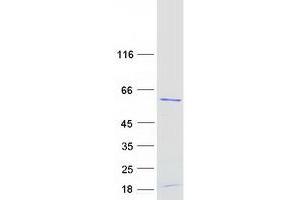 Validation with Western Blot