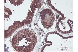 Immunohistochemical staining of paraffin-embedded Human breast tissue using anti-CNDP2 mouse monoclonal antibody. (CNDP2 抗体)