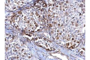 Immunohistochemistry (IHC) image for anti-DNA Repair Protein Homolog 1 (RAD51) (Center) antibody (ABIN2854762)