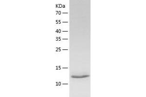 Western Blotting (WB) image for Interleukin 5 (IL5) (AA 20-134) (Active) protein (His tag) (ABIN7123601)