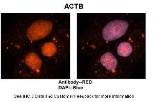 Immunohistochemistry (IHC) image for anti-Actin, beta (ACTB) (Middle Region) antibody (ABIN2778644)