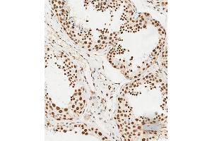 C staining HS in human testis tissue sections by Immunohistochemistry (IHC-P - paraformaldehyde-fixed, paraffin-embedded sections). (HSPA7 抗体  (AA 169-196))