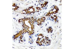 Immunohistochemistry (IHC) image for anti-Cytochrome P450, Family 26, Subfamily A, Polypeptide 1 (CYP26A1) antibody (ABIN7266654)