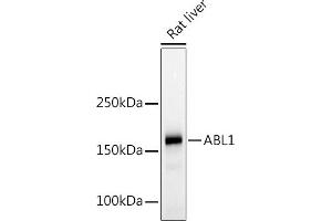 Western blot analysis of extracts of Rat liver, using c-Abl Rabbit pAb (ABIN3020871, ABIN3020872, ABIN3020873 and ABIN6213767) at 1:500 dilution. (ABL1 抗体  (AA 490-590))