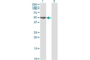 Western Blot analysis of SEPT10 expression in transfected 293T cell line by SEPT10 monoclonal antibody (M02), clone 3A9.