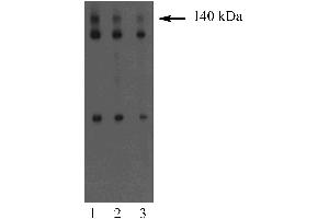 Western blot analysis of Dlg on an A431 cell lysate (Human epithelial carcinoma, ATCC CRL-1555). (DLG1 抗体  (AA 5-213))
