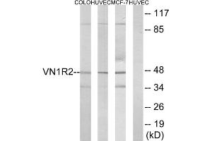 Western blot analysis of extracts from COLO cells, HUVEC cells and MCF-7 cells, using VN1R2 antibody. (VN1R2 抗体  (Internal Region))