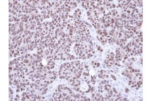 IHC-P Image Immunohistochemical analysis of paraffin-embedded SW480 xenograft, using NSMCE1, antibody at 1:500 dilution. (NSMCE1 抗体  (Center))