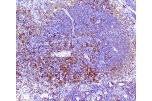 IHC analysis of RP2 using anti-RP2 antibody (ABIN6719513).