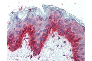 Immunohistochemistry (IHC) image for anti-Transcription Factor AP-2 gamma (Activating Enhancer Binding Protein 2 Gamma) (TFAP2C) (Middle Region) antibody (ABIN2777941)