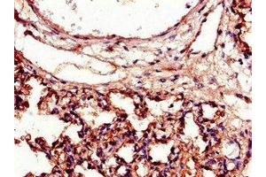Immunohistochemistry of paraffin-embedded human lung tissue using ABIN7156533 at dilution of 1:100 (ICAM1 抗体  (AA 320-480))